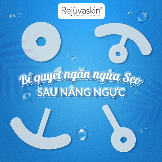 Làm thế nào để quản lý và ngăn ngừa sẹo nâng ngực ngay sau khi lành thương?- Ảnh 1.