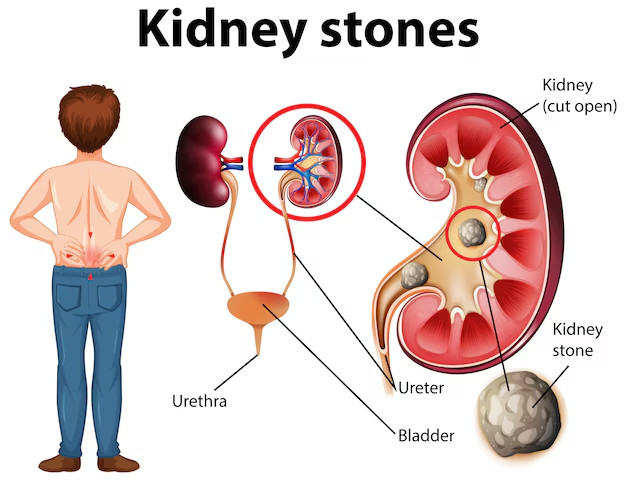 Bác sĩ tiết lộ tác dụng không ngờ của uống nước chanh hằng ngày- Ảnh 2.