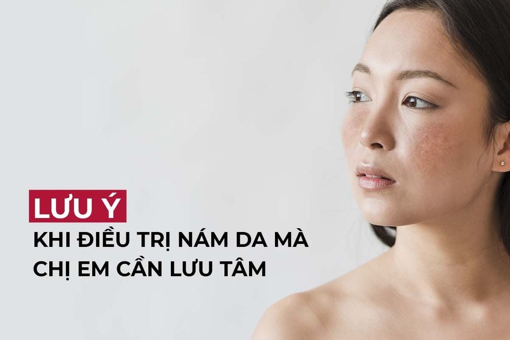 Những lưu ý khi điều trị nám da mà chị em để đạt hiệu quả tốt nhất – TaeHui  Việt Nam