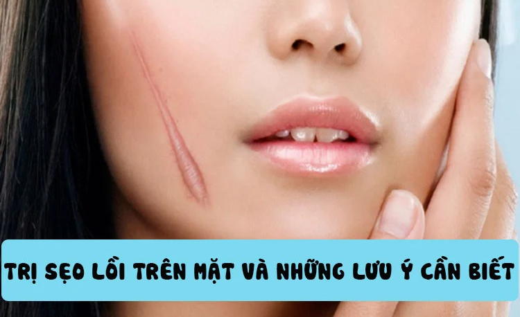 Bật mí cách trị sẹo lồi trên mặt hiệu quả tại nhà mà không cần xâm lấn- Ảnh 1.