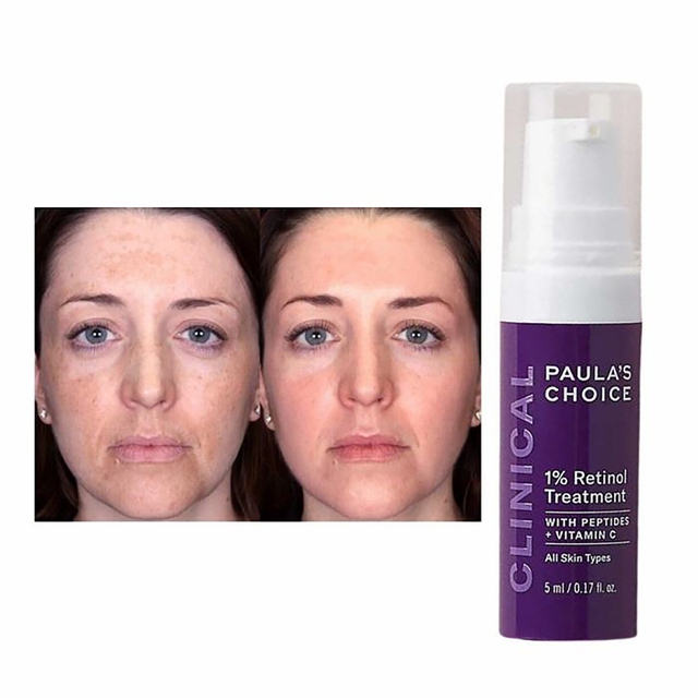 Hiệu quả của tinh chất Paula's Choice Clinical 1% Retinol Treatment đã được chứng thực trong nhiều cuộc khảo sát uy tín