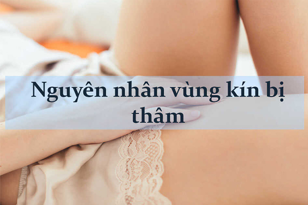 Top 8 Kem Trị Thâm Vùng Kín, Làm Hồng Vùng Kín Tốt Nhất