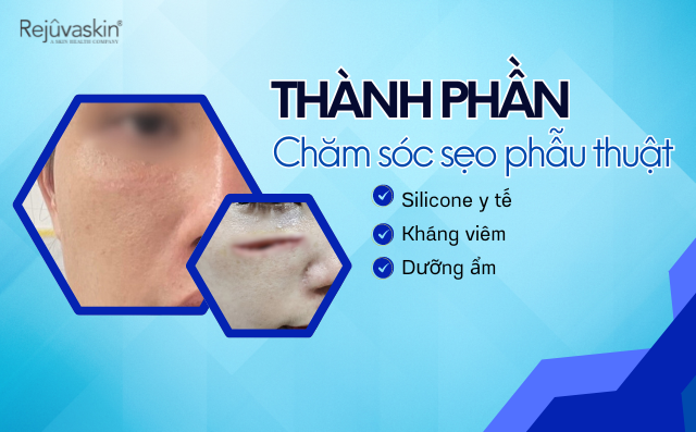 Điểm tên những thành phần chăm sóc da tốt cho sẹo phẫu thuật- Ảnh 1.