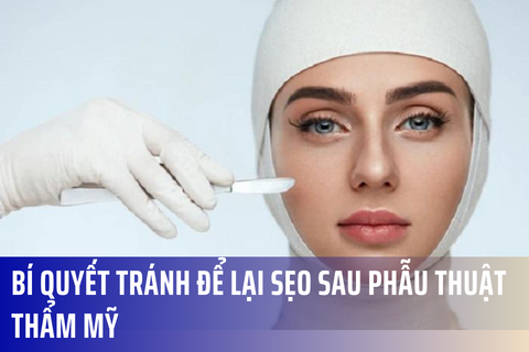 Bí quyết tránh để lại sẹo sau phẫu thuật thẩm mỹ – Merinco