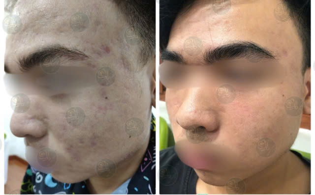 Rejuvaskin Việt Nam và Pearl Clinic xây dựng mối quan hệ hợp tác cùng phát triển- Ảnh 2.