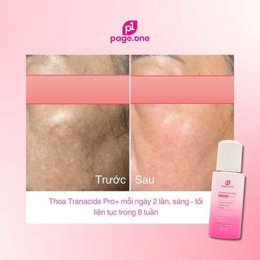 Top 3 serum trị nám dứt điểm ngừa tái phát được hội chị em review tích cực- Ảnh 3.