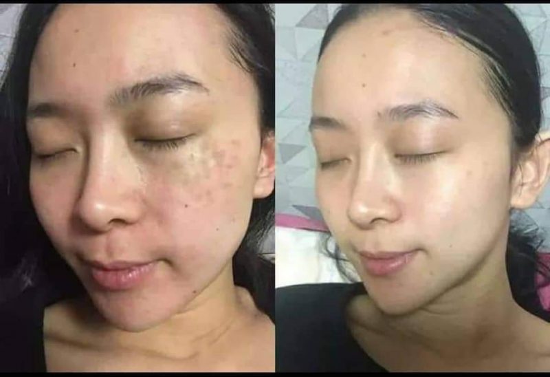 Kem đêm làm sáng da MartiDerm Pigment Zero DSP Renovation Cream