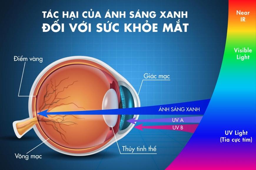 Bảo vệ đôi mắt trẻ: Hiểu và giảm thiểu tác động của ánh sáng xanh- Ảnh 2.