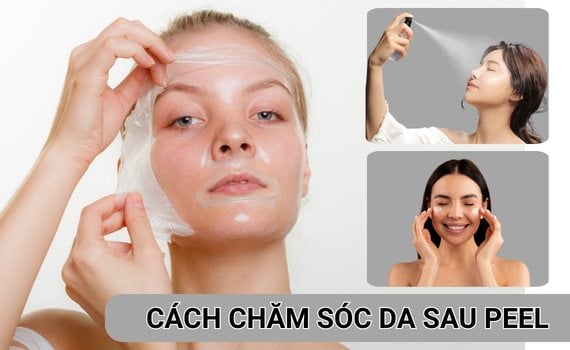 Liệu trình chăm sóc da sau peel đúng chuẩn y khoa da khỏe đẹp rạng rỡ- Ảnh 1.