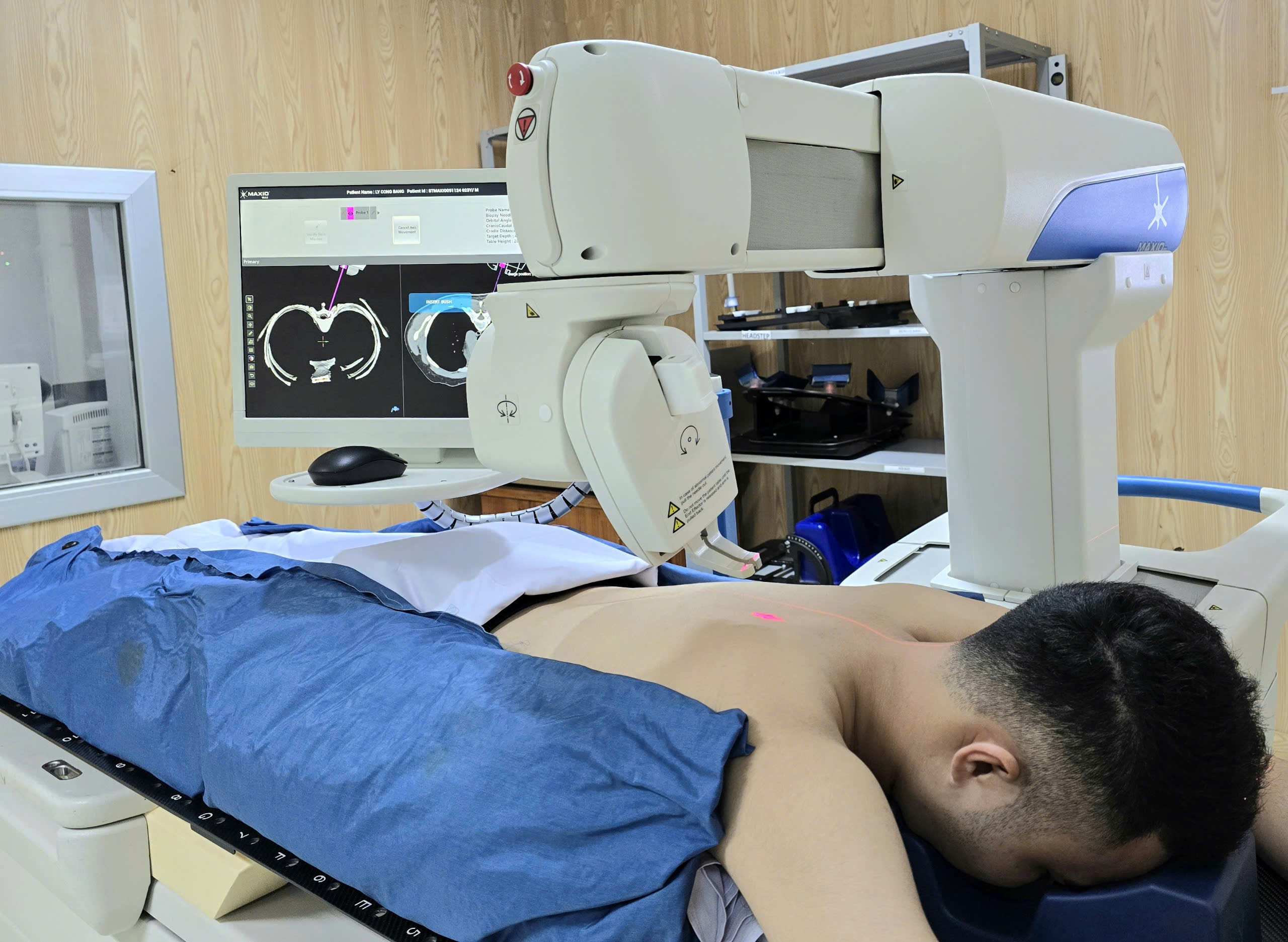 Kỹ thuật sinh thiết xương hiện đại tại Bệnh viện Quân y 175- Ảnh 2. Kỹ thuật sinh thiết xương hiện đại tại Bệnh viện Quân y 175- Ảnh 2.