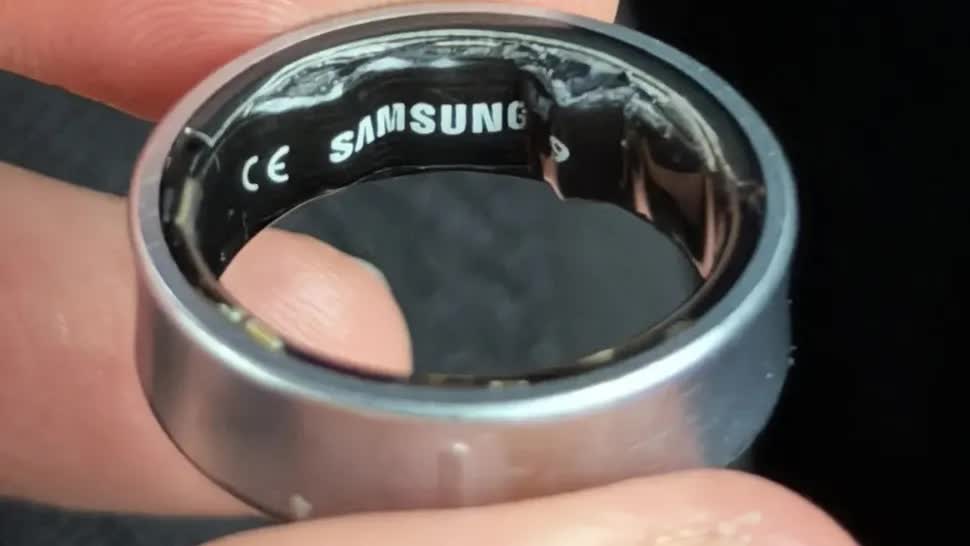 Nhập viện vì Galaxy Ring gặp sự cố pin phồng - Ảnh 1.