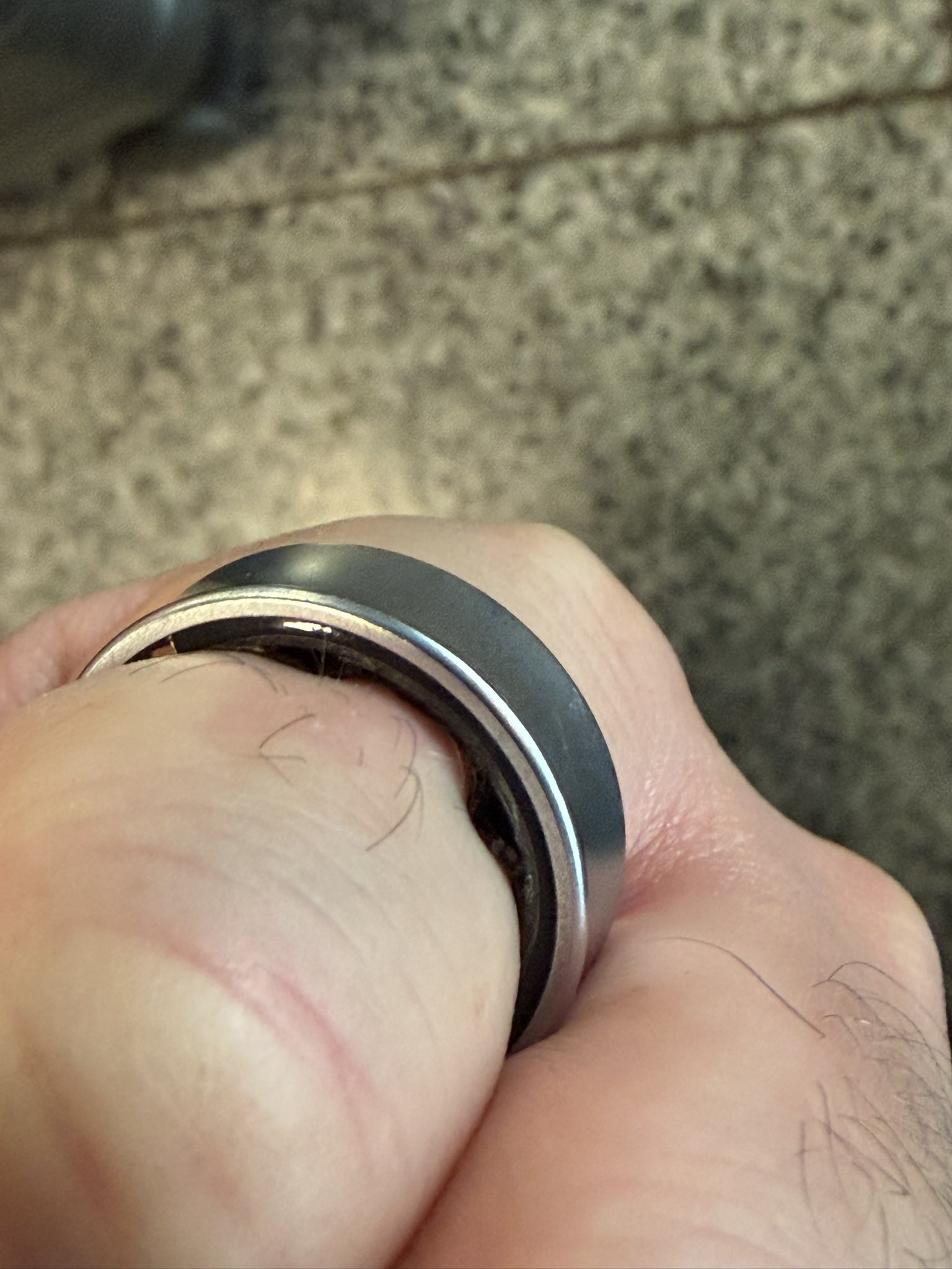 Nhập viện vì Galaxy Ring gặp sự cố pin phồng - Ảnh 2.
