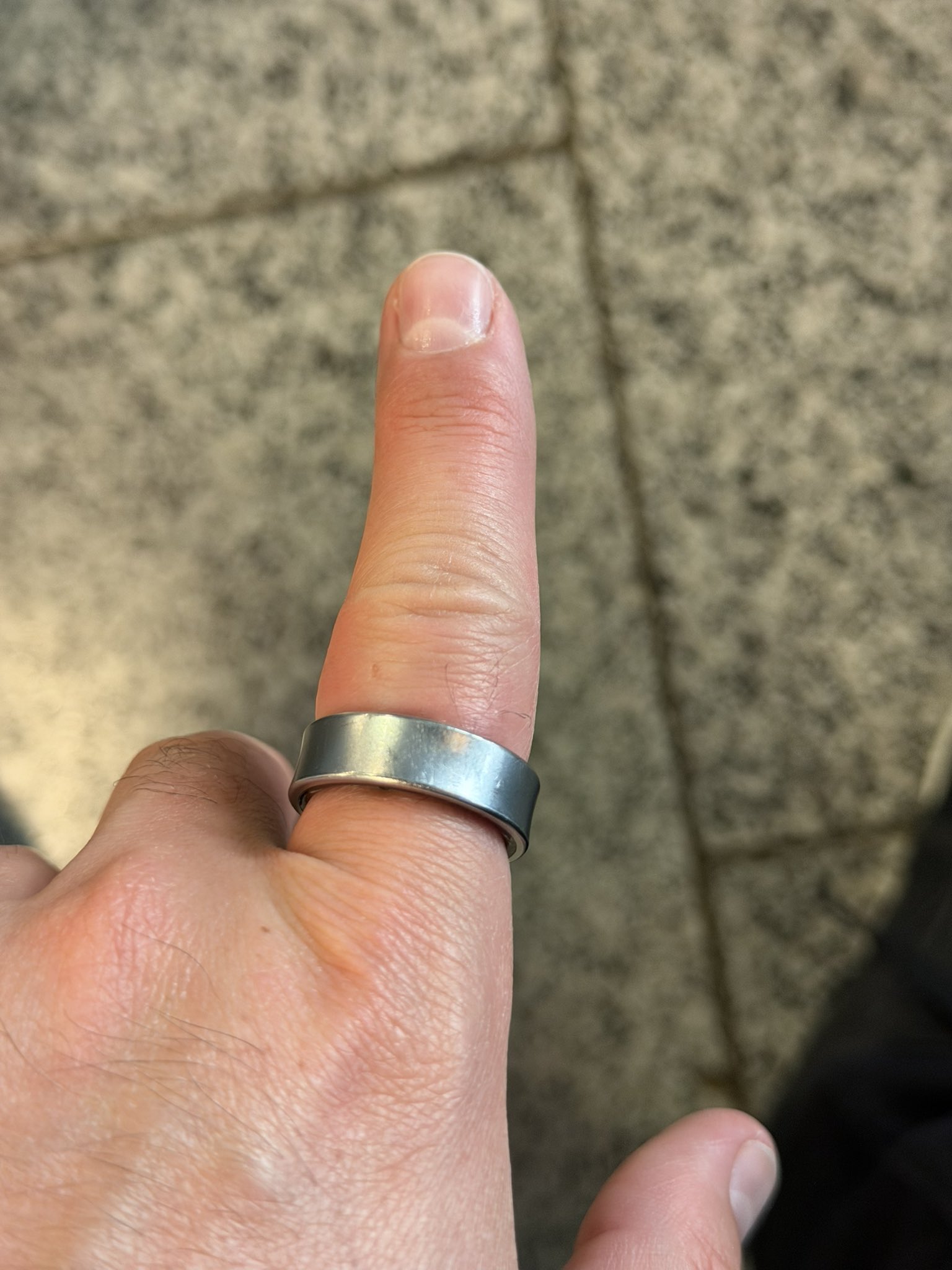 Nhập viện vì Galaxy Ring gặp sự cố pin phồng - Ảnh 3.
