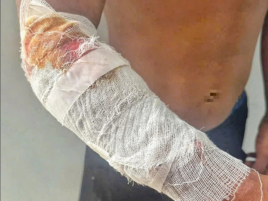 Bắt được cá sấu dài 2,6 m nghi tấn công người ở Khánh Hòa - Ảnh 2.