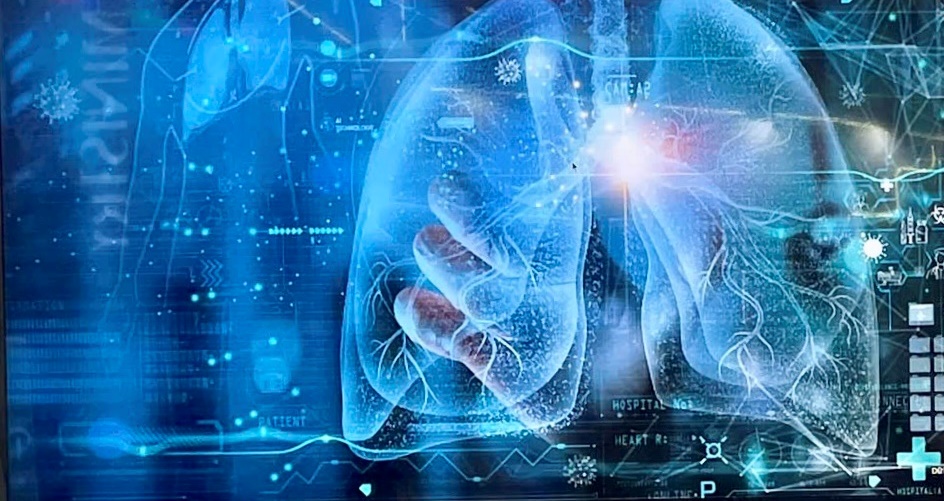 Ứng dụng AI chẩn đoán ung thư phổi giúp tăng cường khả năng phát hiện bệnh - Ảnh 1. Ứng dụng AI chẩn đoán ung thư phổi giúp tăng cường khả năng phát hiện bệnh - Ảnh 1.