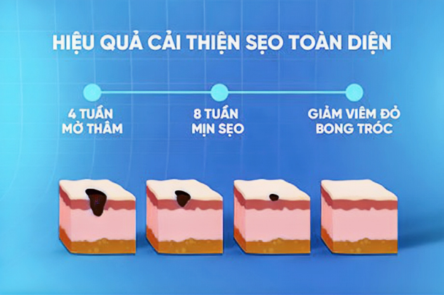 Tạm biệt sẹo rỗ, 5 b&iacute; k&iacute;p chăm s&oacute;c da phục hồi da sau mụn hiệu quả - Ảnh 3.