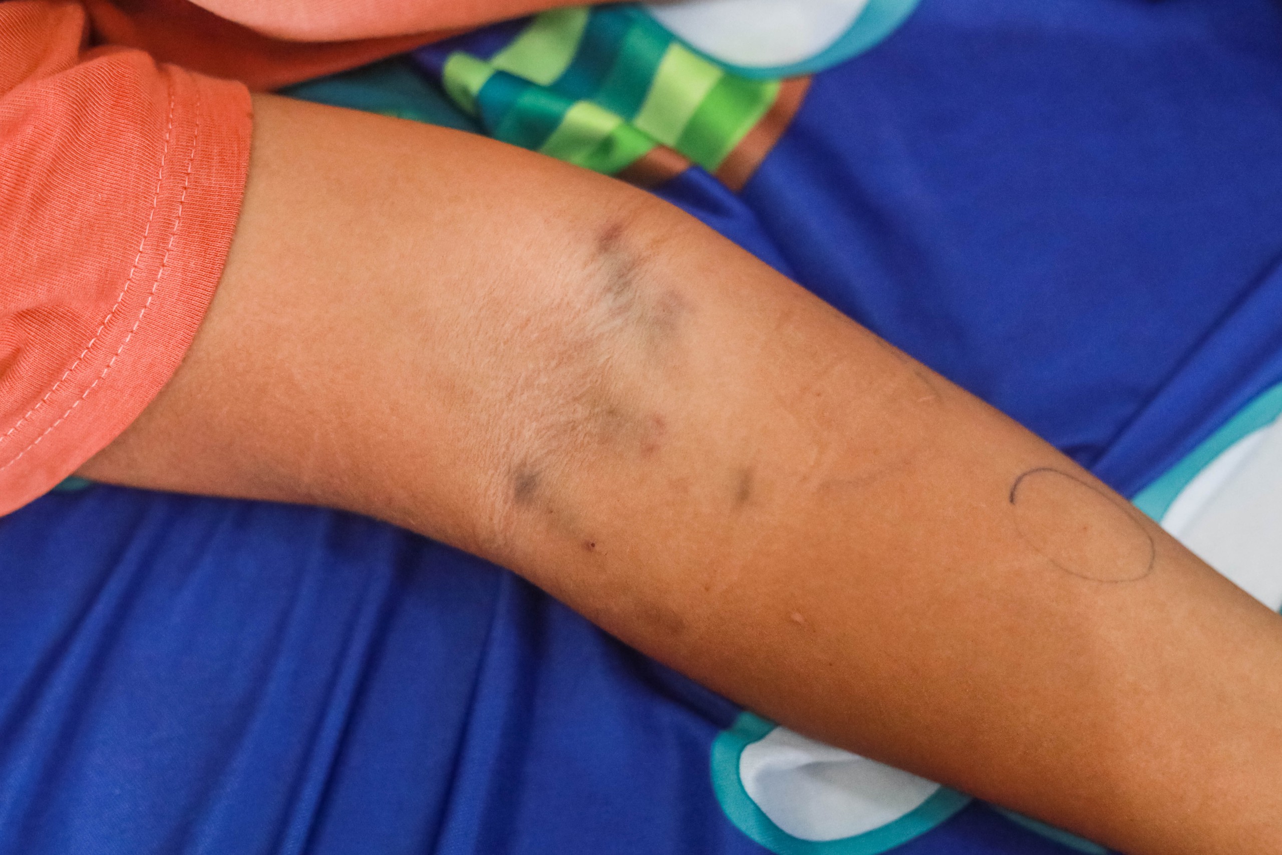 Con muốn sống: Bé trai ung thư 'xin mẹ sinh em khác để con được chết'- Ảnh 3. Con muốn sống: Bé trai ung thư 'xin mẹ sinh em khác để con được chết'- Ảnh 3.