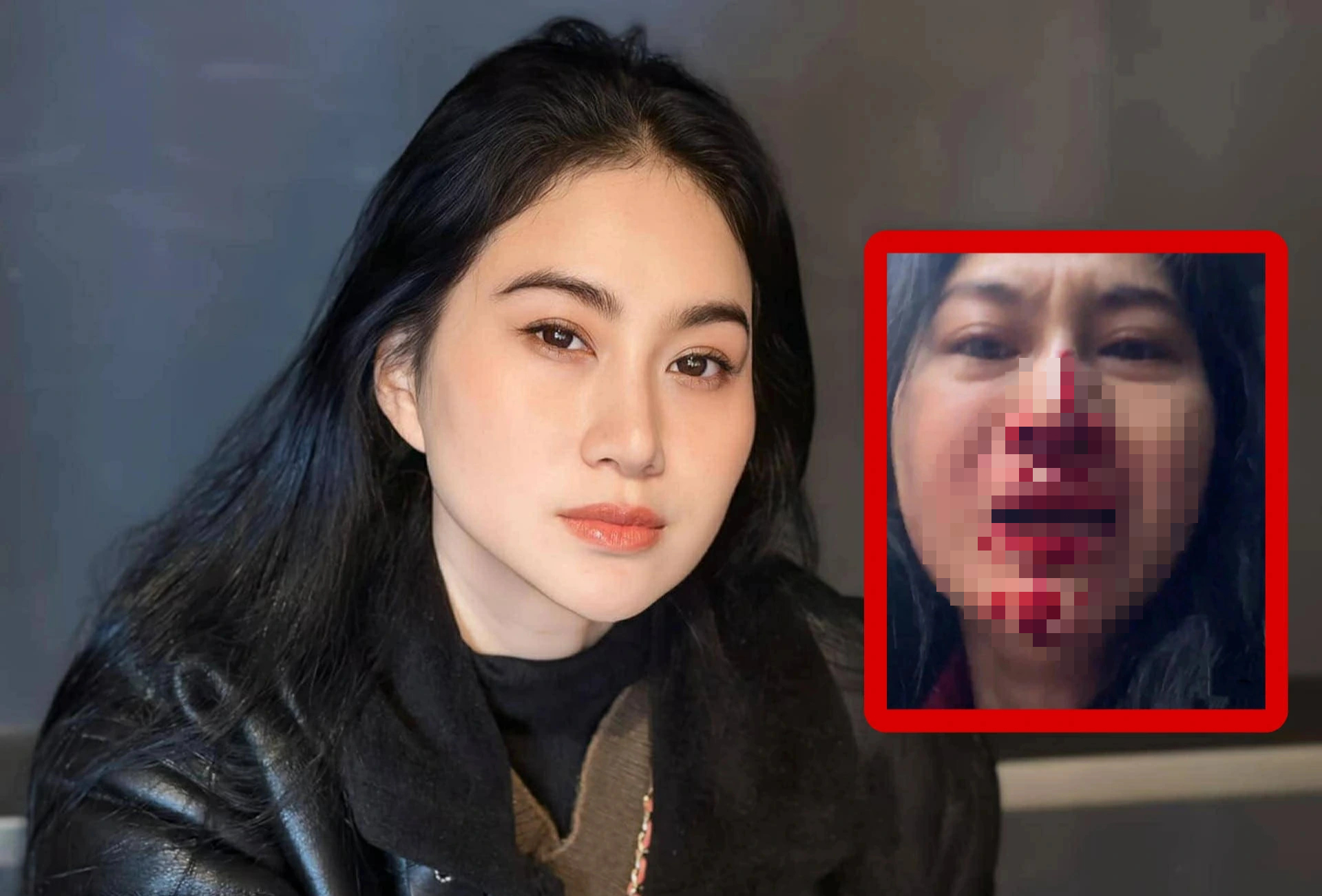 Xôn xao hình ảnh Phi Ngọc Ánh mặt đầy máu me, cầu cứu trên livestream - Ảnh 1.