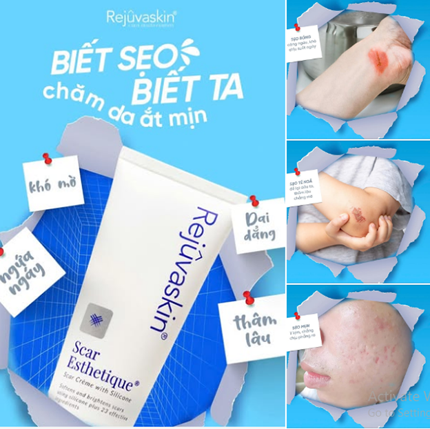 Hướng dẫn sử dụng kem mờ thâm mụn Rejuvaskin Scar Esthetique đúng chuẩn cho da trắng sáng - Ảnh 2.