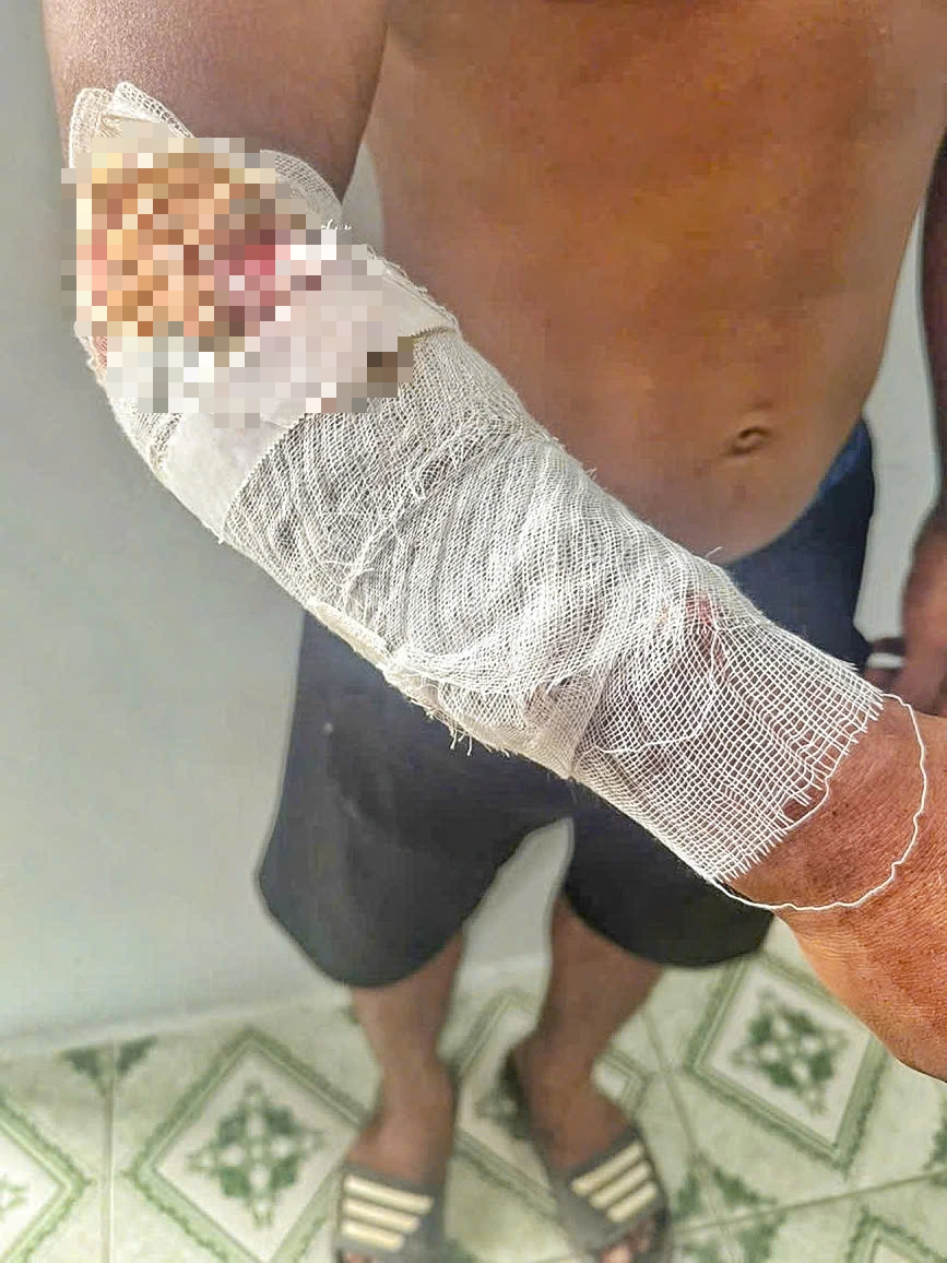 Khánh Hòa: Nam thanh niên bị cá sấu tấn công khi câu cá - Ảnh 1.