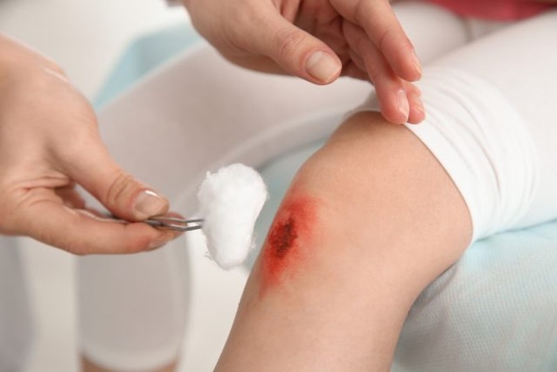 Thực hiện vệ sinh vết loét đúng quy chuẩn y khoa giúp ngăn ngừa nhiễm trùng và thúc đẩy quá trình lành thương