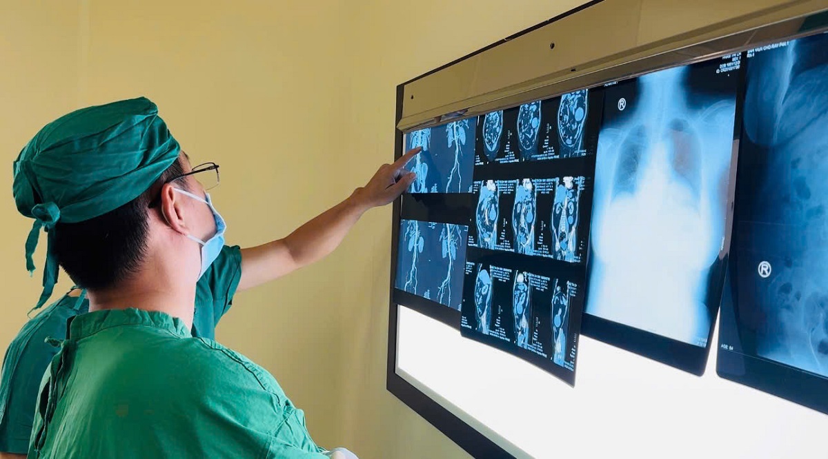 Khám sức khỏe tổng quát, bác sĩ phát hiện khối bướu bất thường ở thận - Ảnh 1.