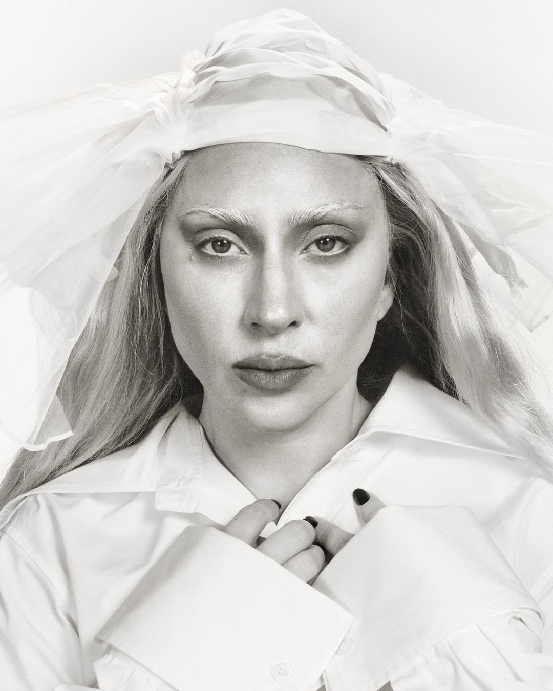 Lady Gaga từng phải điều trị tâm thần - Ảnh 1.