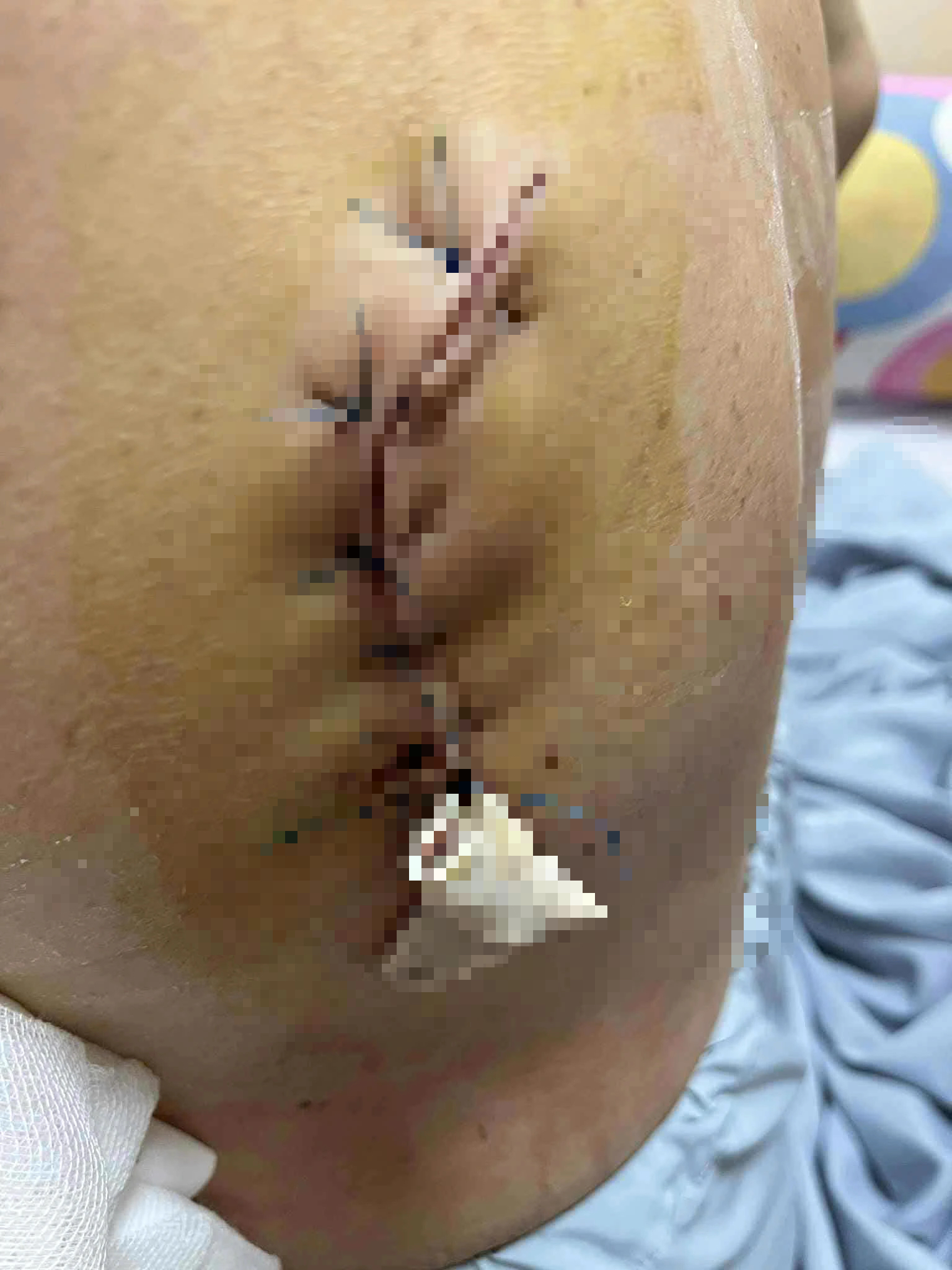 Điều tra vụ người phụ nữ bị tấn công bằng hung khí khi đang tập thể dục - Ảnh 9.