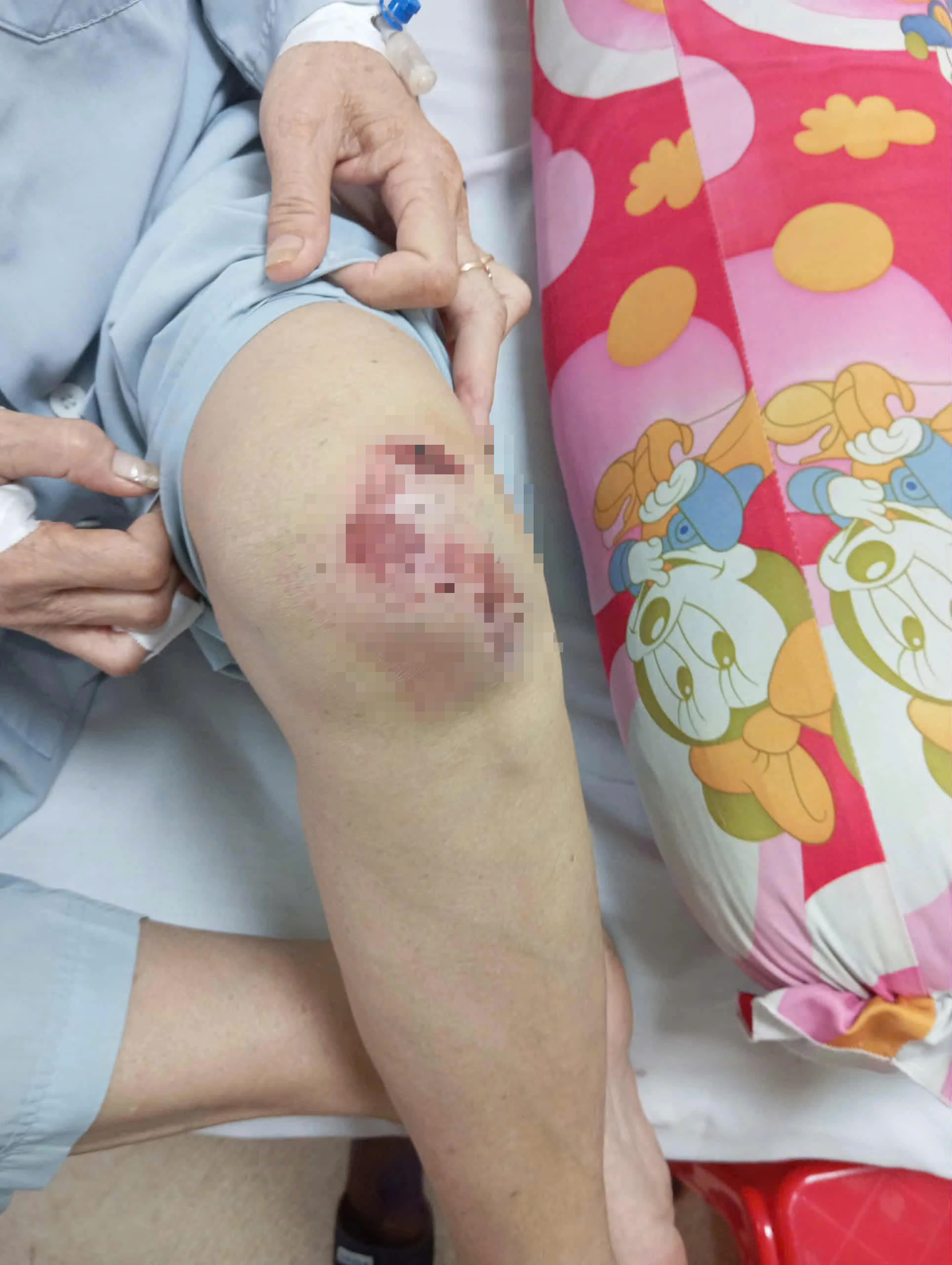 Điều tra vụ người phụ nữ bị tấn công bằng hung khí khi đang tập thể dục - Ảnh 6.