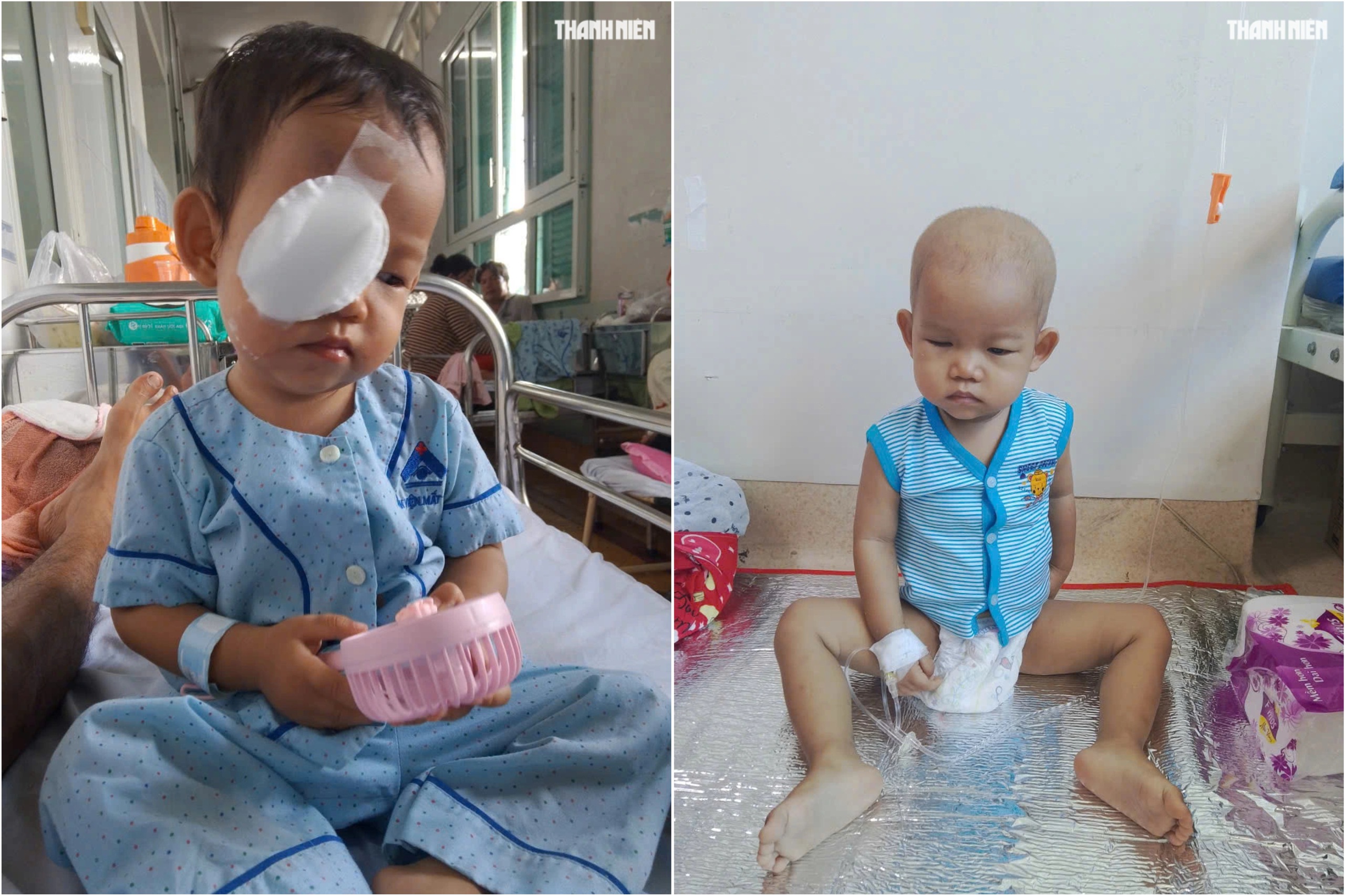 Bé trai nguy cơ mất ánh sáng vì ung thư mắt, gia đình kiệt quệ cầu cứu- Ảnh 2.