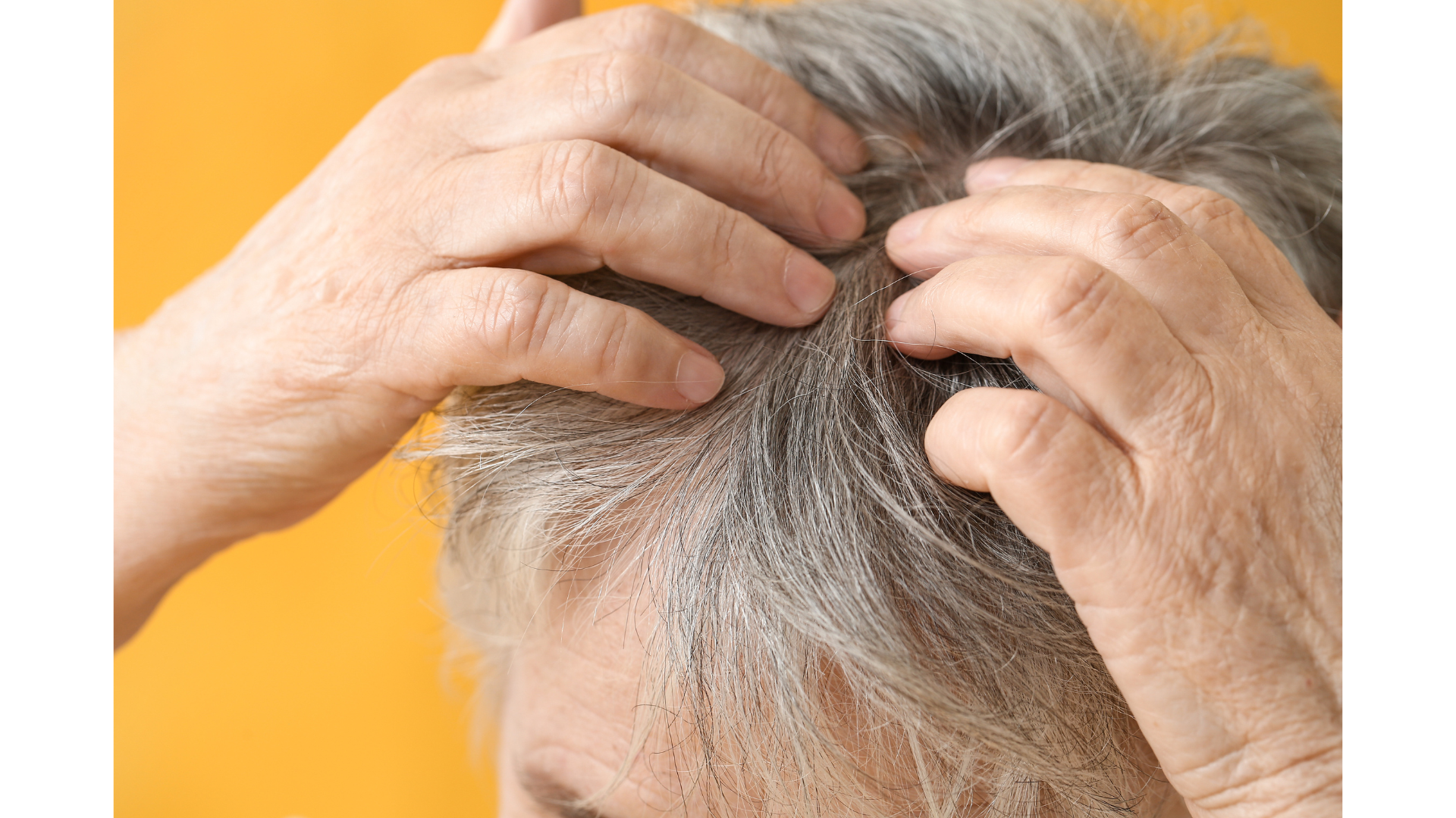 Tóc bạc: phản ứng tự nhiên giúp cơ thể ngăn ngừa ung thư- Ảnh 1.