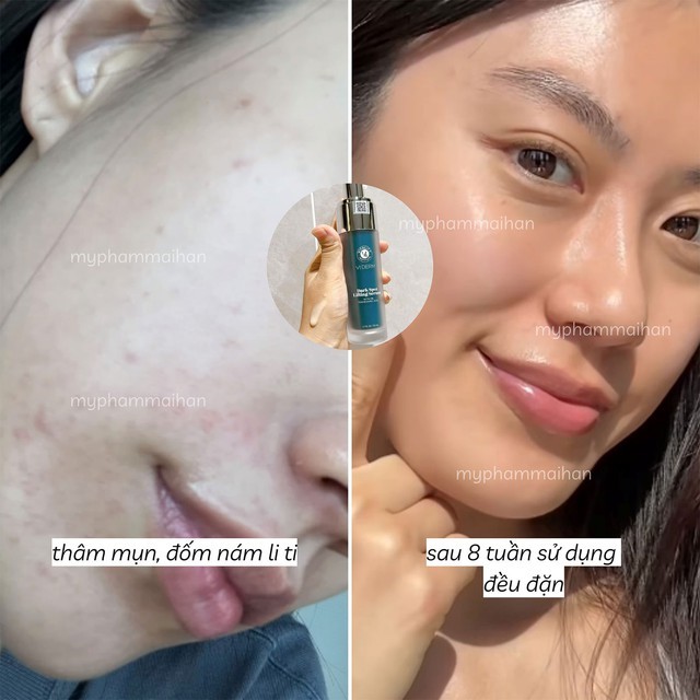Top 3 kem Retinol êm dịu mà cải thiện nếp nhăn cực đỉnh, muốn già cũng khó- Ảnh 3. Top 3 kem Retinol êm dịu mà cải thiện nếp nhăn cực đỉnh, muốn già cũng khó- Ảnh 3.