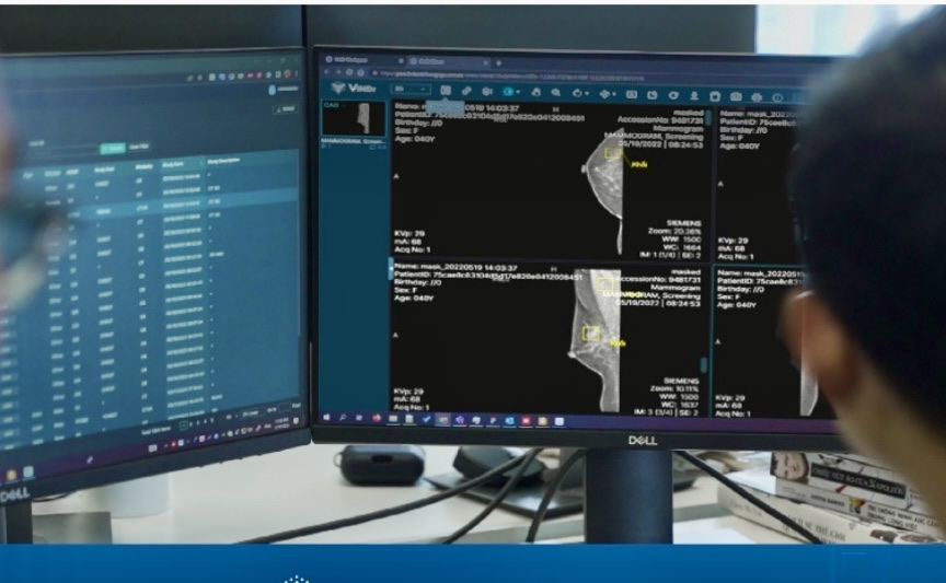 - Ảnh 1. Việt Nam có sản phẩm AI chẩn đoán X-quang tuyến vú được FDA công nhận - Ảnh 1.