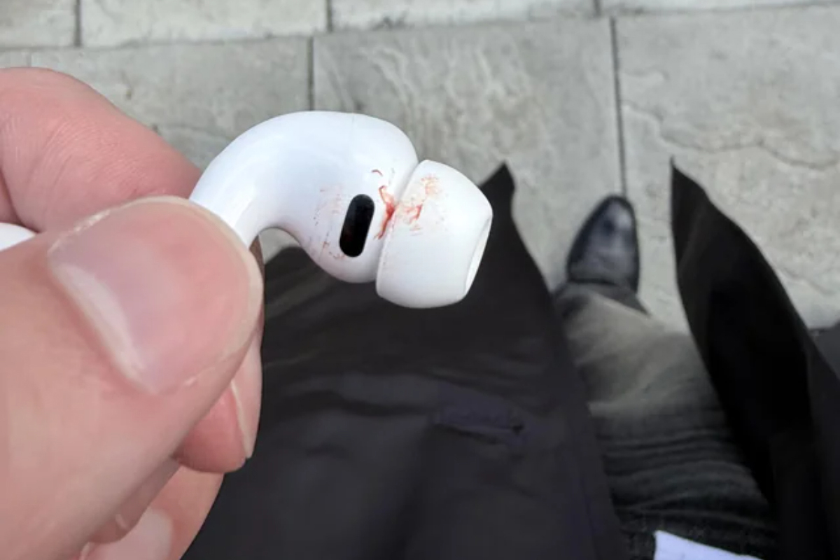 Người dùng tá hỏa vì AirPods Pro 3 gây chảy máu tai - Ảnh 1.