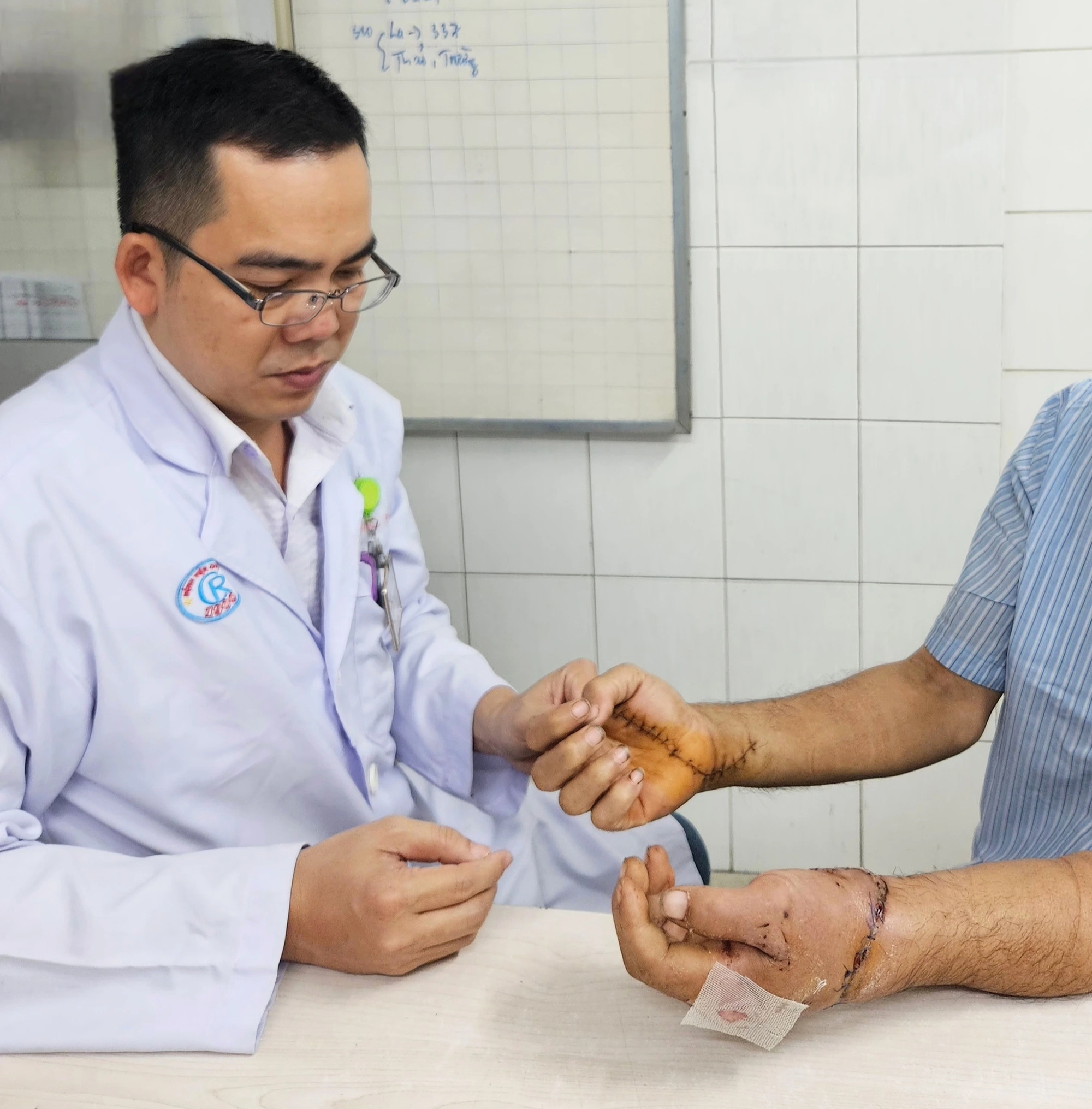 Bệnh viện Chợ Rẫy 'báo động đỏ’, 12 giờ nối 2 tay đứt lìa cho bệnh nhân- Ảnh 2. Bệnh viện Chợ Rẫy 'báo động đỏ’, 12 giờ nối 2 tay đứt lìa cho bệnh nhân- Ảnh 2.