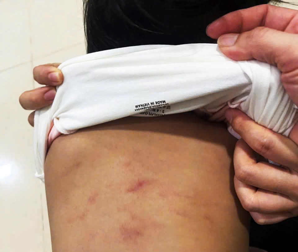 Cà Mau: Đề nghị công an điều tra trẻ 2 tuổi nghi bị bạo hành - Ảnh 1.