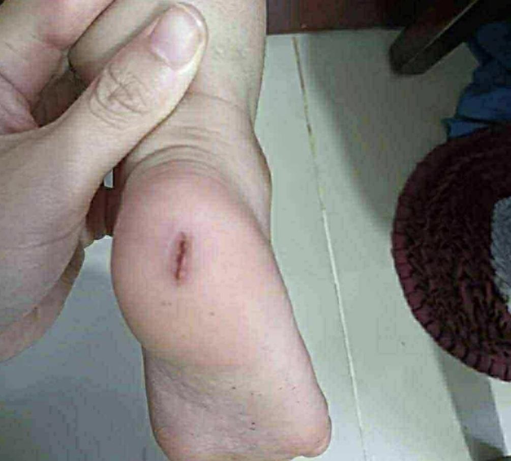 Cà Mau: Đề nghị công an điều tra trẻ 2 tuổi nghi bị bạo hành - Ảnh 2.