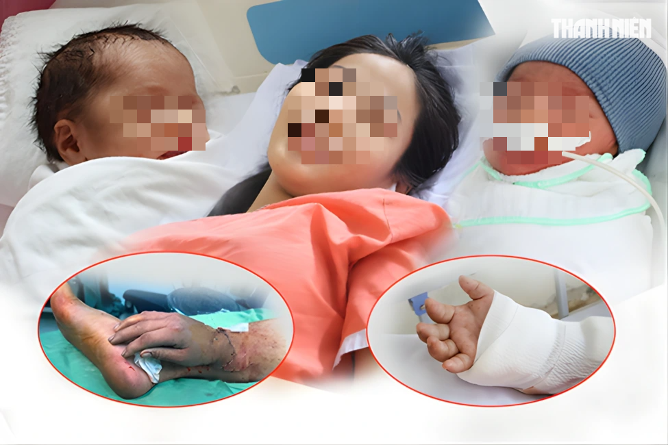 Sản phụ song thai được nối bàn tay đứt lìa ở TP.HCM: 'Tôi bật khóc'- Ảnh 1. Sản phụ song thai được nối bàn tay đứt lìa ở TP.HCM: 'Tôi bật khóc'- Ảnh 1.