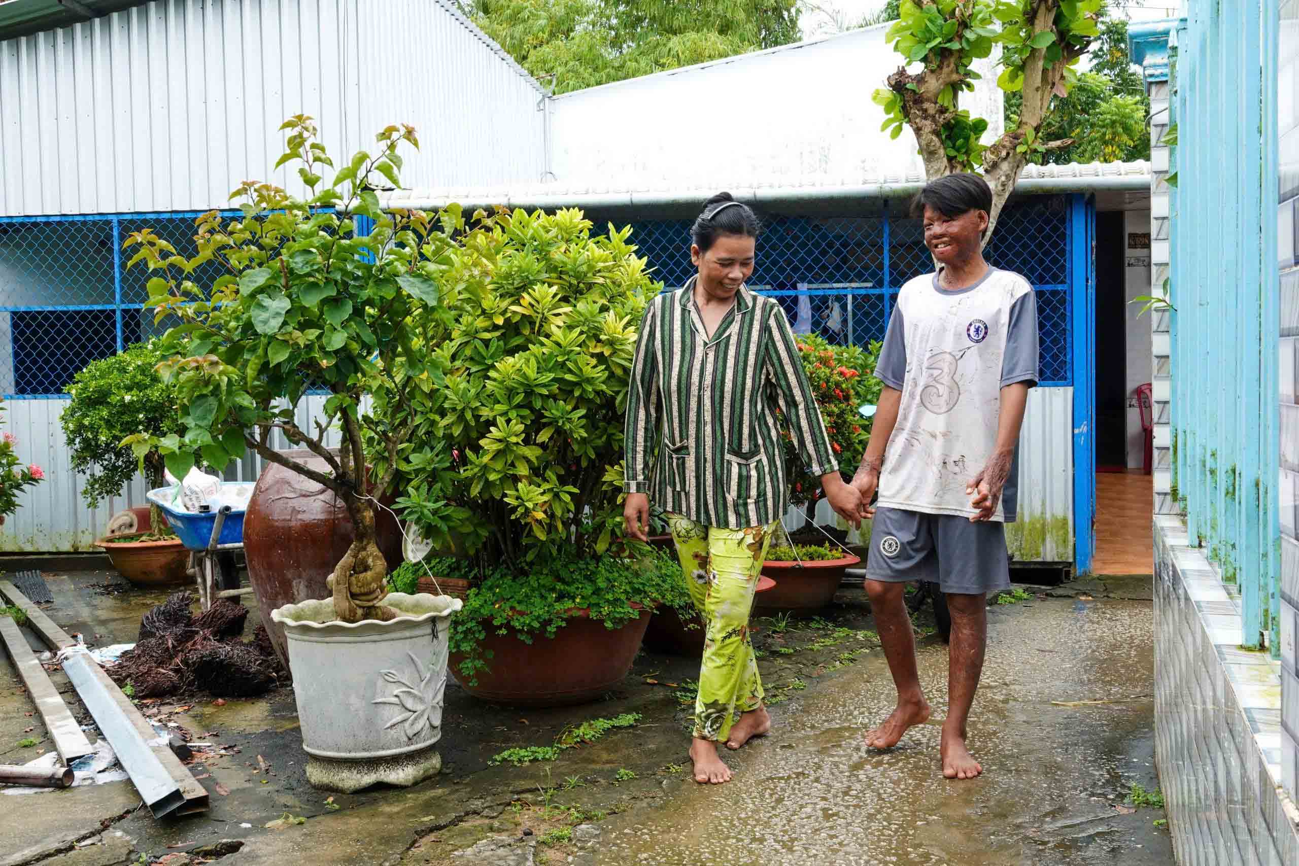 Cậu bé bị bỏng 96% và tấm lòng bạn đọc - Ảnh 1.