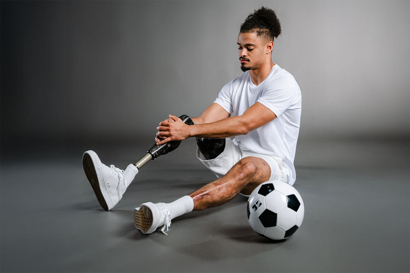 Nỗi đau người mẹ khi con trai cầu thủ cắt bỏ chân vì bệnh não mô cầu - Ảnh 2.