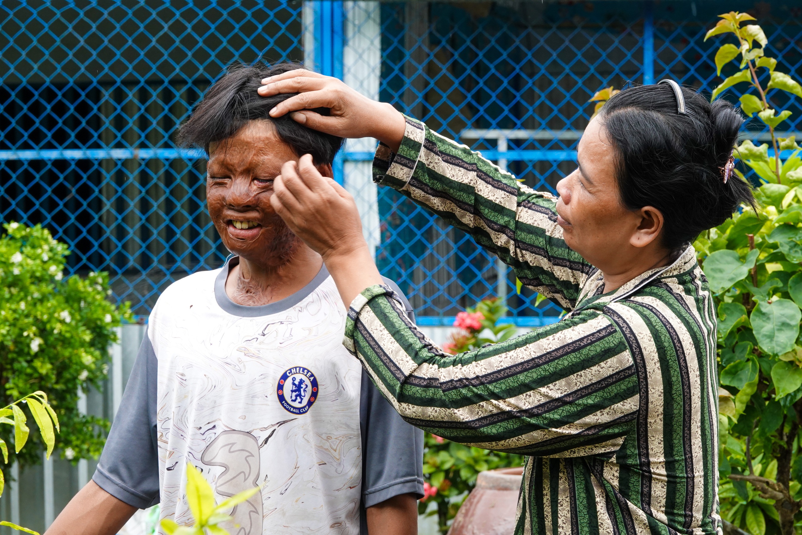 Cậu bé bị bỏng 96% và tấm lòng bạn đọc - Ảnh 2.