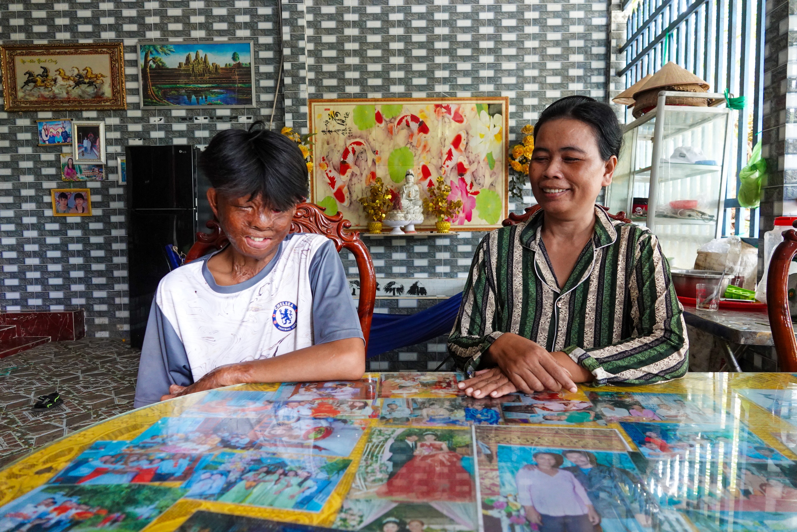 Cậu bé bị bỏng 96% và tấm lòng bạn đọc - Ảnh 4.