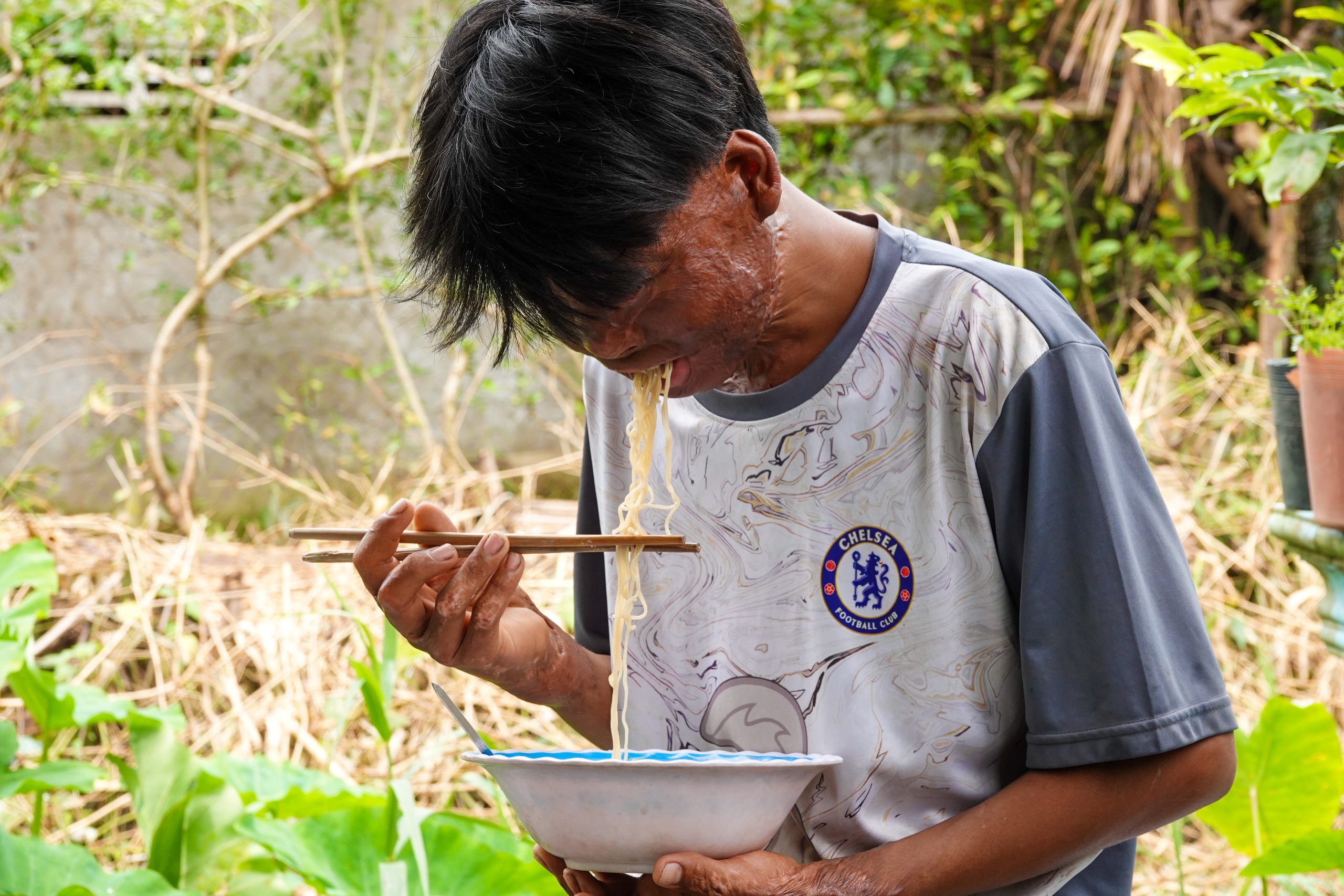 Cậu bé bị bỏng 96% và tấm lòng bạn đọc - Ảnh 3.