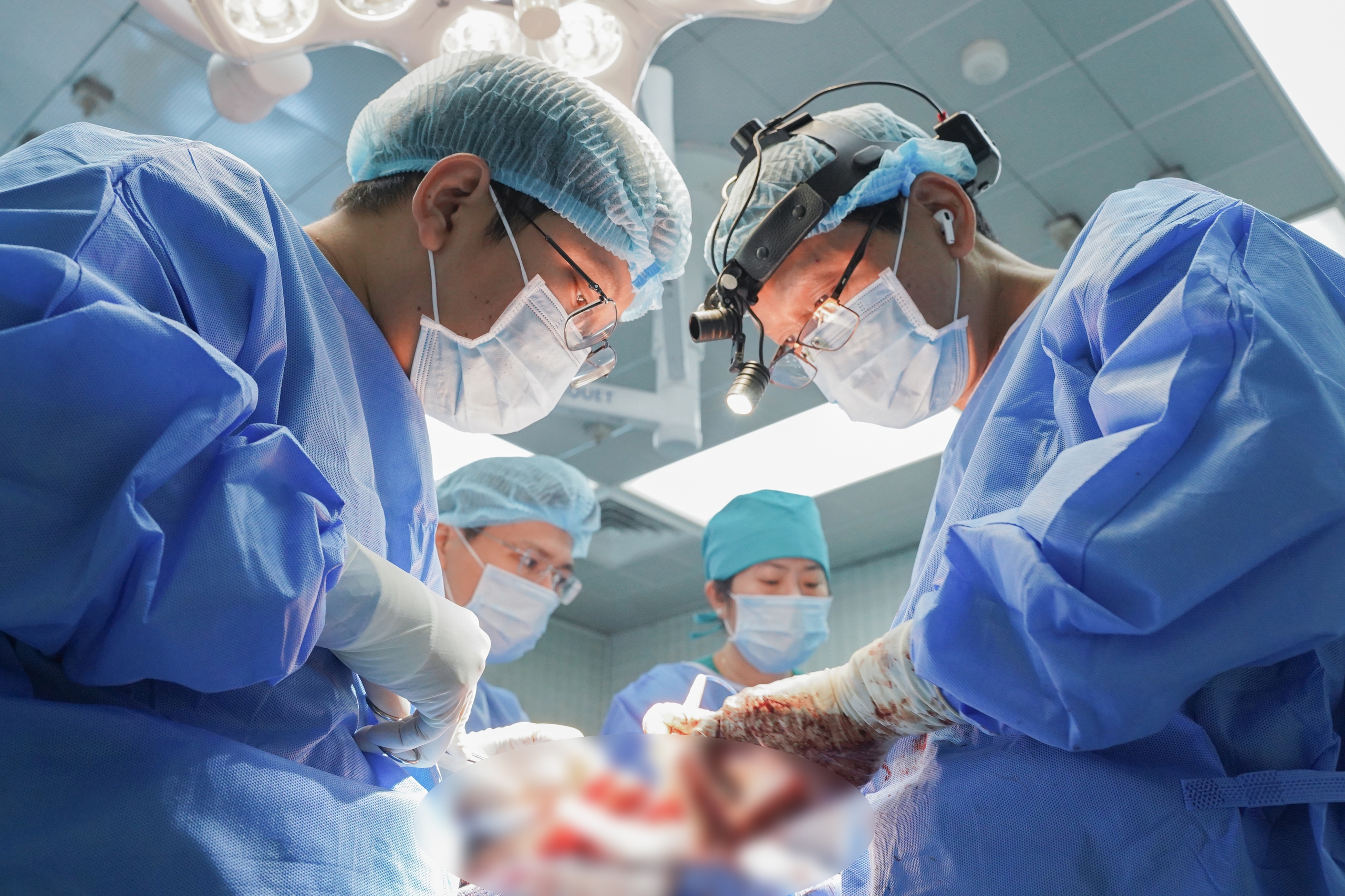 Bệnh viện Chợ Rẫy 'trả lại' gương mặt cho bệnh nhân bị u khủng làm biến dạng- Ảnh 2.