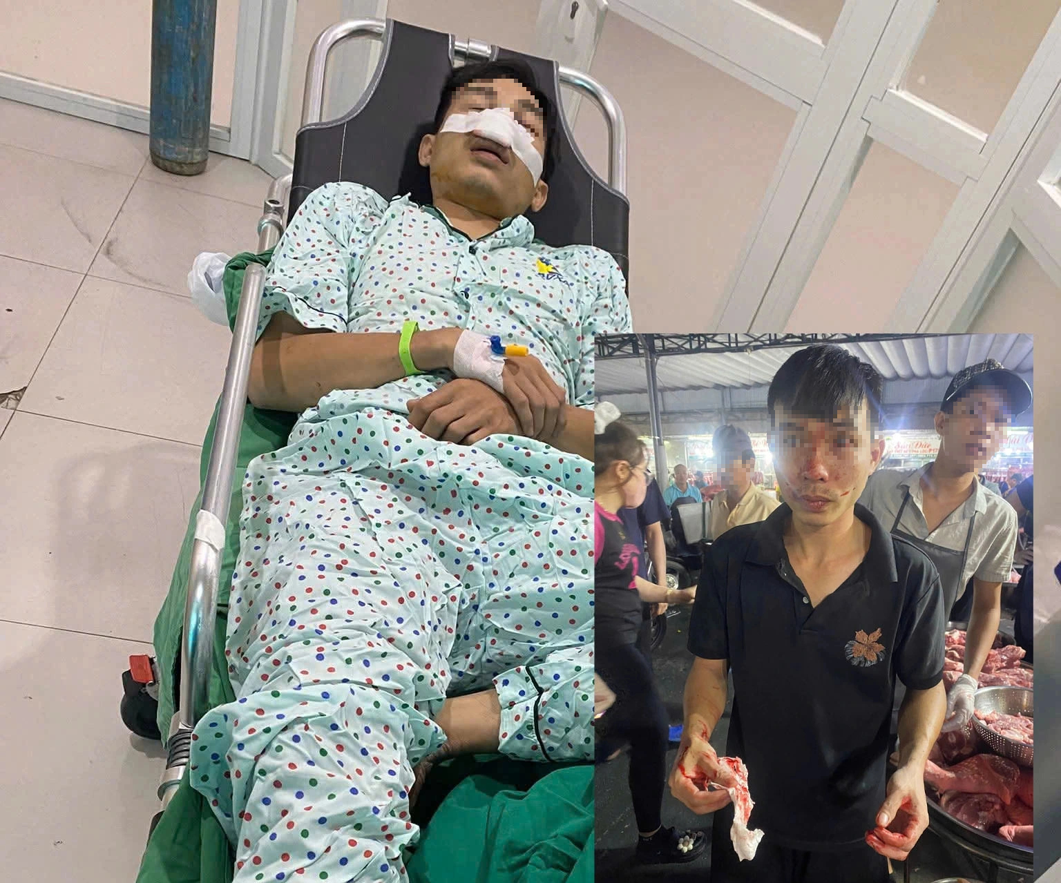 Người đàn ông bị đánh ở chợ đầu mối Hóc Môn phải nhập viện- Ảnh 1.