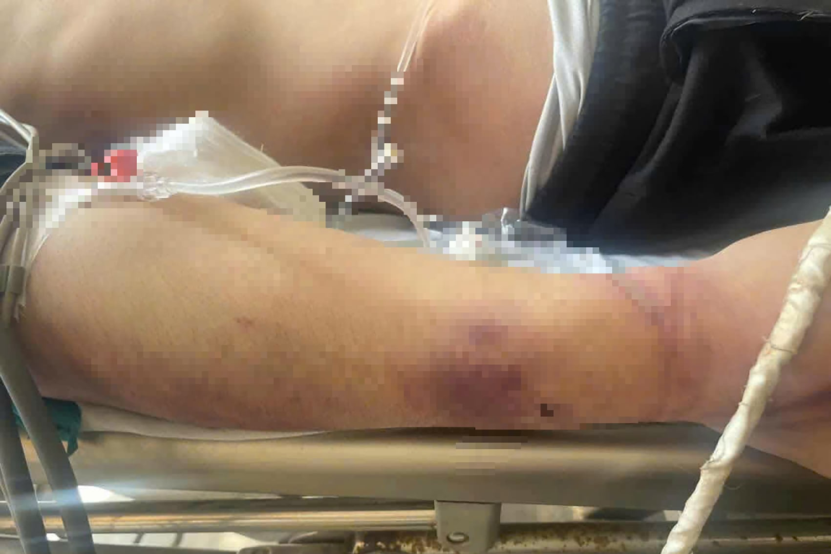 Đình chỉ trung tâm công tác xã hội ở Quảng Ninh sau vụ học viên tử vong  - Ảnh 2.