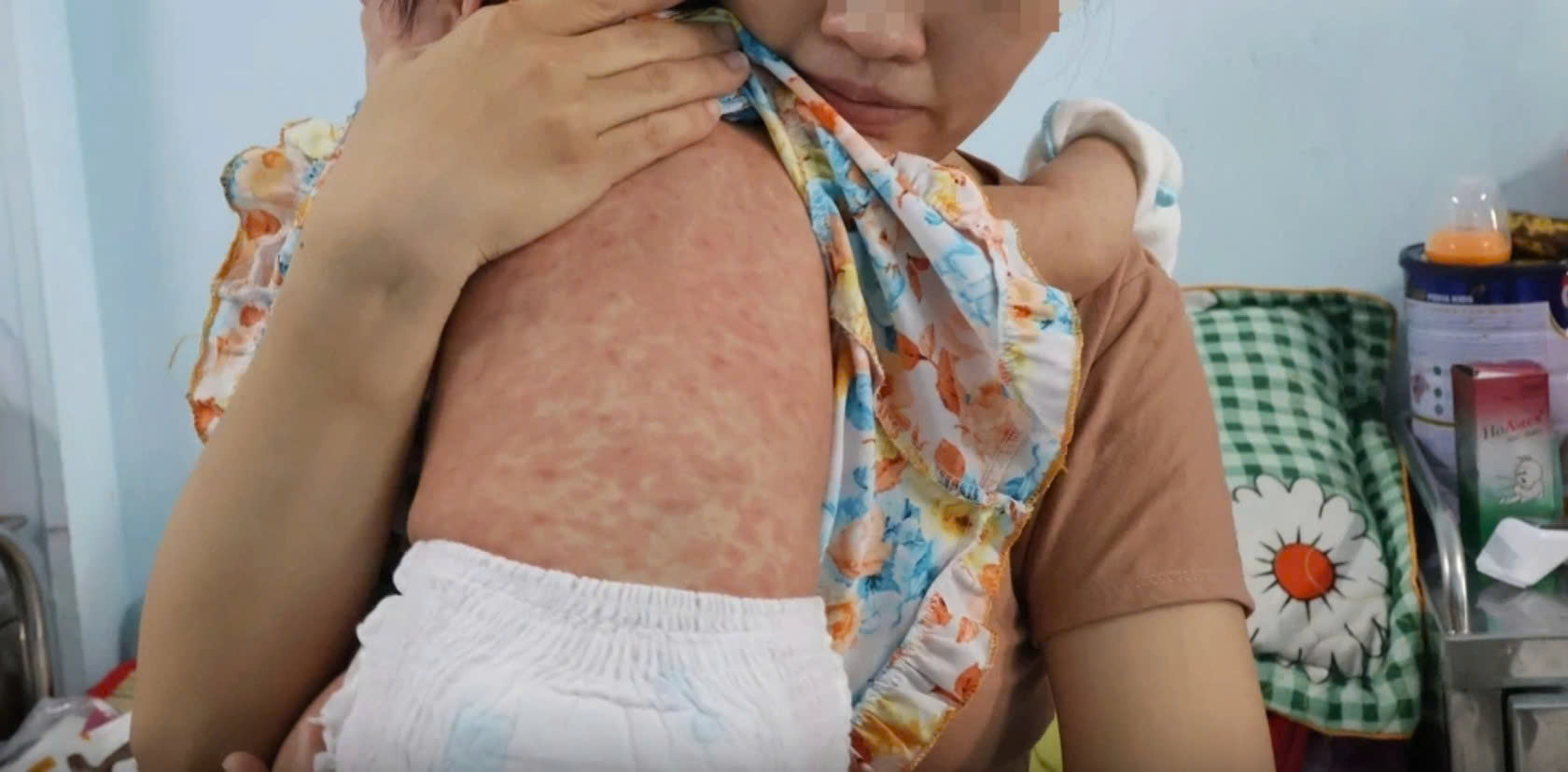 Năm 2025, ngành y tế TP.HCM đã làm được gì?- Ảnh 4.