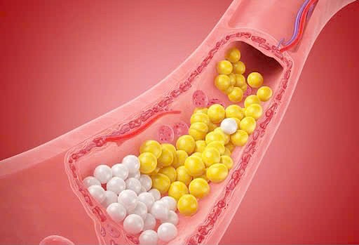 cholesterol