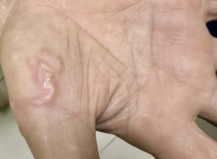 Làm thế nào phòng ngừa nhiễm giun sán từ thú cưng?