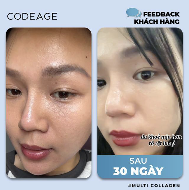 Hướng dẫn cách uống collagen chuẩn chuyên gia đạt hiệu quả cao, không tác dụng phụ- Ảnh 8.